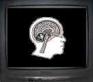 "L'abuso di tv come possibile concausa di lesioni cerebrali e demenza" (sabato 9 febbraio 2008)