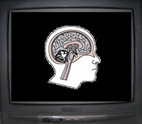 L'abuso di tv come possibile concausa di lesioni cerebrali e demenza.