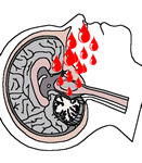 Il sangue, penetrando nel cervello, vi porta anche lossigeno di cui disgraziatamente  ricco, e questo pu rendere il pensiero di gran lunga pi agile. Per questo gli zombie sono cos astuti.